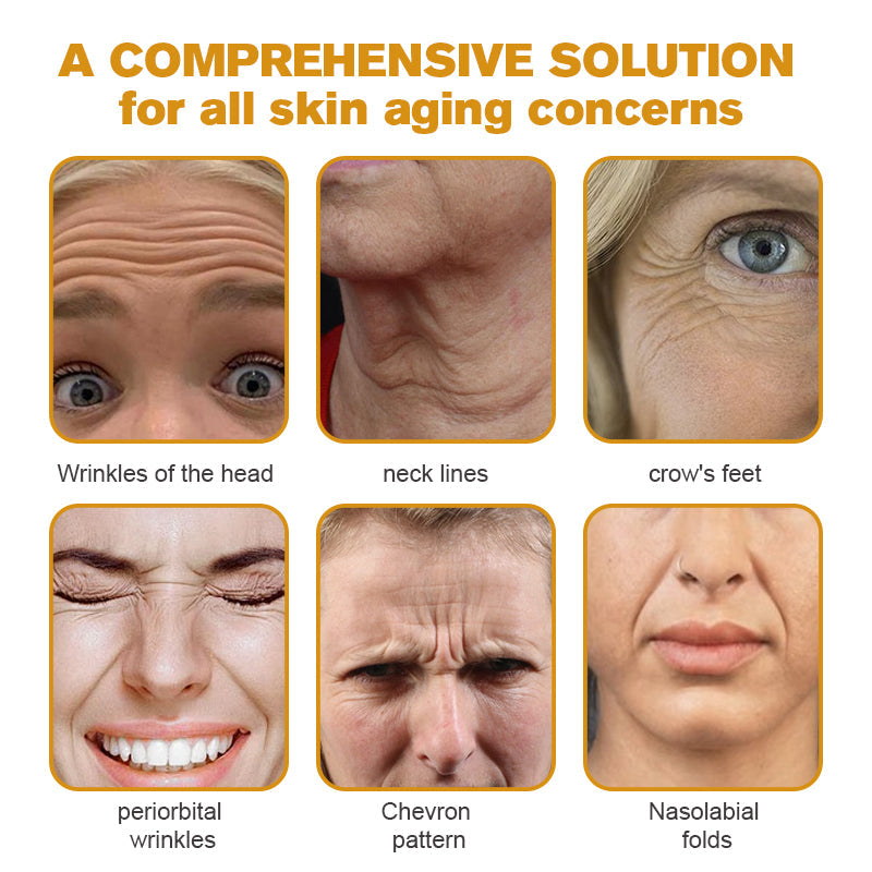 (🛰️Made and Shipped from Canada✅) 👩⚕️Furzero™ Botox Bee Venom Wrinkle Removal Cream-(LAST DAY 70% OFF)