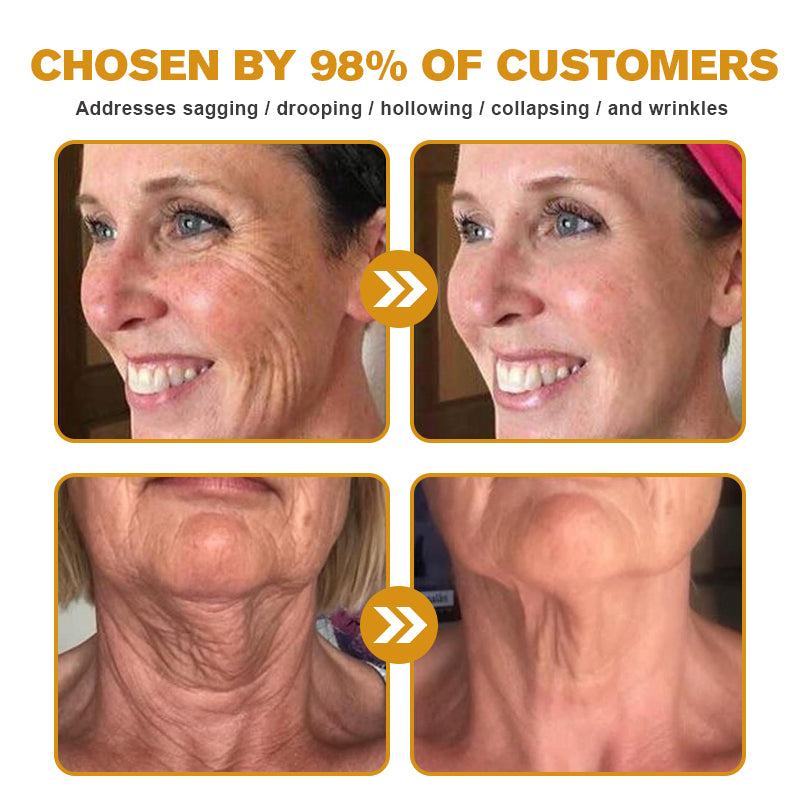 (🛰️Made and Shipped from Canada✅) 👩⚕️Furzero™ Botox Bee Venom Wrinkle Removal Cream-(LAST DAY 70% OFF)