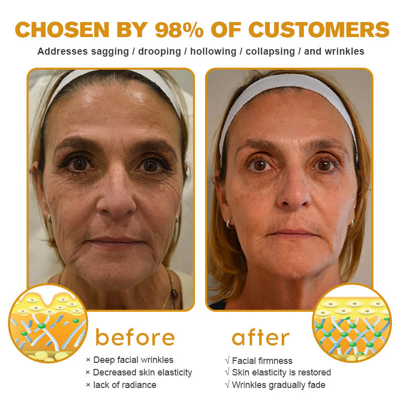 (🛰️Made and Shipped from Canada✅) 👩⚕️Furzero™ Botox Bee Venom Wrinkle Removal Cream-(LAST DAY 70% OFF)