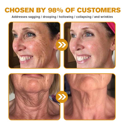 (🛰️Made and Shipped from Canada✅) 👩‍⚕️Furzero™ Botox Bee Venom Wrinkle Removal Cream-(LAST DAY 70% OFF)